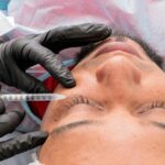 Filler behandlinger – en populær æstetisk løsning til ansigtet