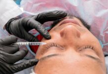 Filler behandlinger – en populær æstetisk løsning til ansigtet